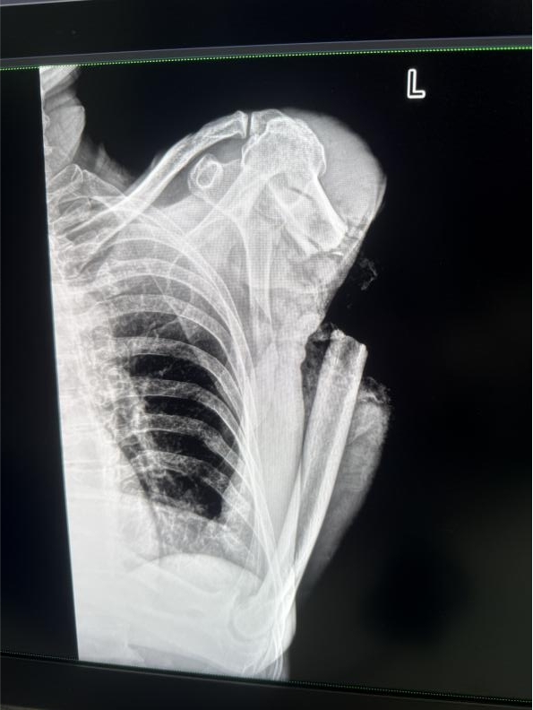 5f8ee43d536b45b2ab82150c3dce7919.jpg 5f8ee43d536b45b2ab82150c3dce7919.jpg